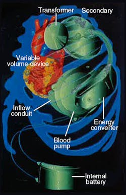 Hydraulicspneumatics Com Sites Hydraulicspneumatics com Files Uploads 2012 06 Figure 1 0 Hydraulicspneumatics Com Sites Hydraulicspneumatics com Files Uploads 2012 06 Figure 1 0