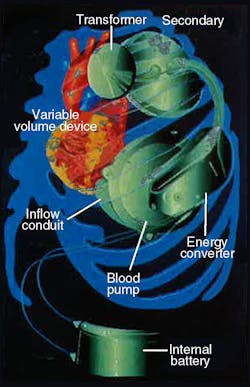 Hydraulicspneumatics Com Sites Hydraulicspneumatics com Files Uploads 2012 06 Figure 1 0 Hydraulicspneumatics Com Sites Hydraulicspneumatics com Files Uploads 2012 06 Figure 1 0