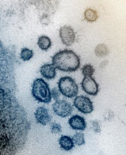 This transmission electron microscope image shows SARS-CoV-2, also known as 2019-nCoV, the virus that causes COVID-19. The spikes on the outer edge of the virus particles give coronaviruses their name, crown-like. This transmission electron microscope image shows SARS-CoV-2, also known as 2019-nCoV, the virus that causes COVID-19. The spikes on the outer edge of the virus particles give coronaviruses their name, crown-like.